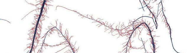 Root architecture