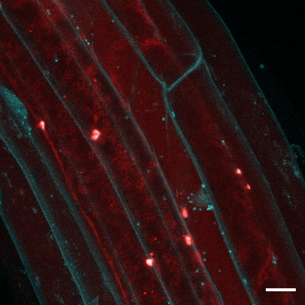 Confocal microscopy of Arabidopsis roots co-expressing ARF7–Venus (cyan) and mCherry–NBR1 (red), visualizing protein localization in living root cells. Confocal microscopy of Arabidopsis roots co-expressing ARF7–Venus (cyan) and mCherry–NBR1 (red), visualizing protein localization in living root cells.