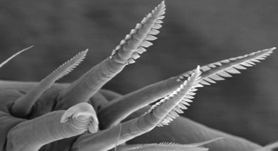 SEM micrograph of crustacean setae