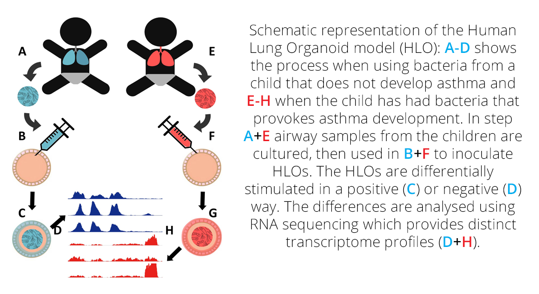 Modeling asthma - a schematic representation