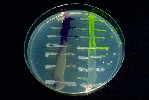 Bacteria plating