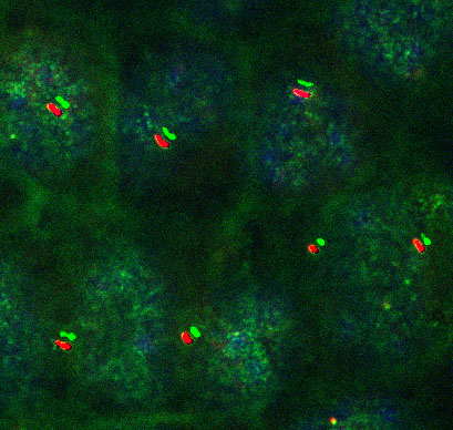 Immunofluorescence image of kidney epithelial cells where the cilia are stained with a red antibody and the protein ZDHHC5 is stained with a green antibody.