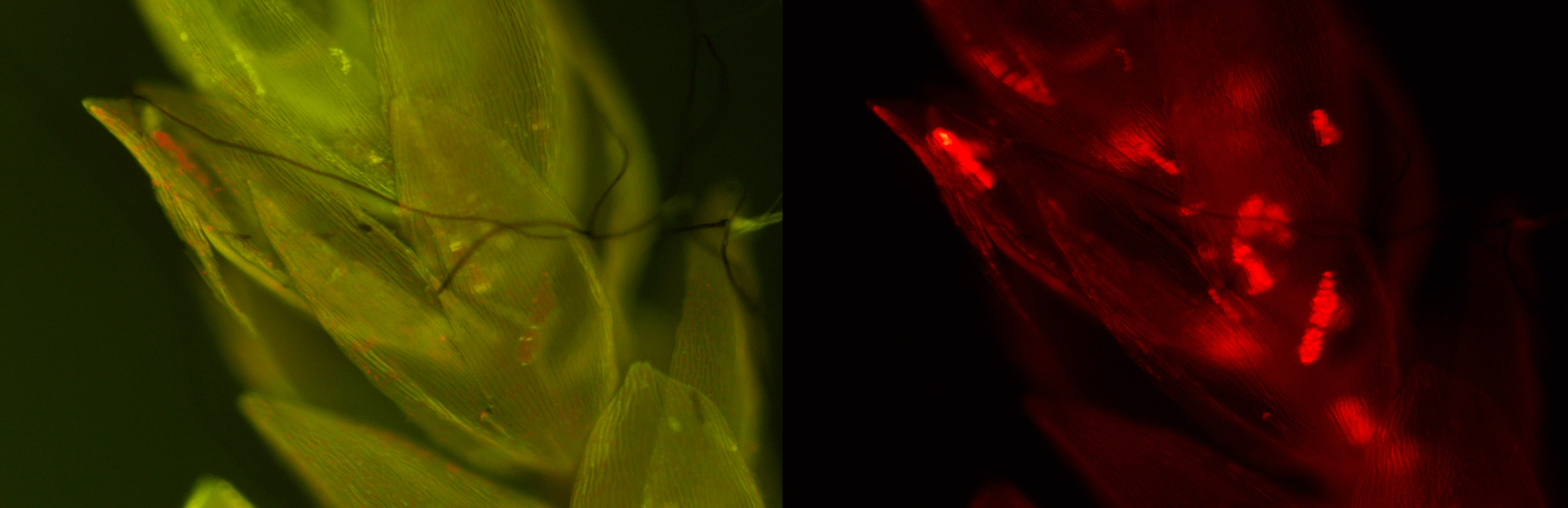 Cyanobacteria - microscopy